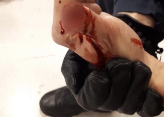 Paris : Un interpellé mord et sectionne un morceau de doigt d’un agent RATP.