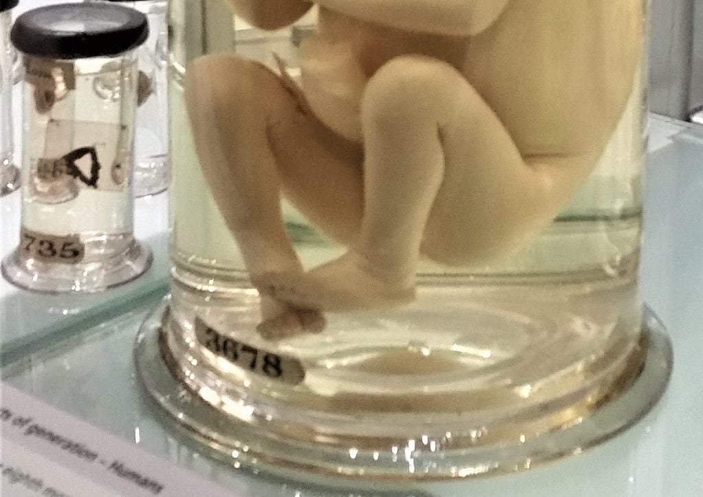 2 246 fœtus humains conservés dans un liquide découverts au domicile d’un médecin