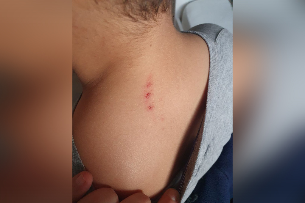 Seine-et-Marne : Une enseignante de Chelles agresse un élève de 8 ans