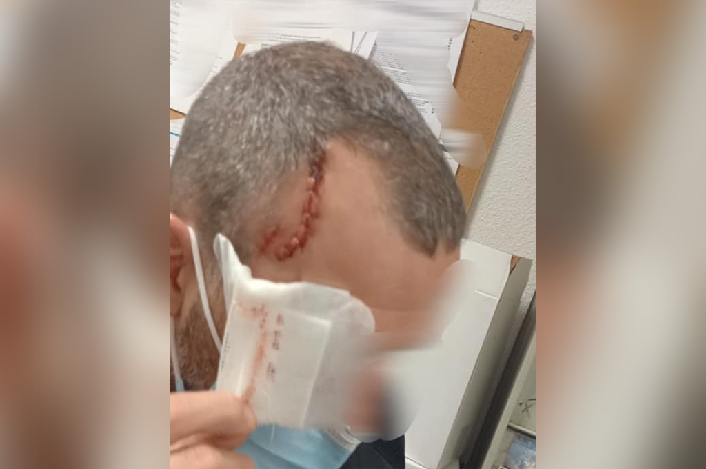 Cannes : Un policier agressé à coup de marteau à la tête et sérieusement blessé lors d'une intervention