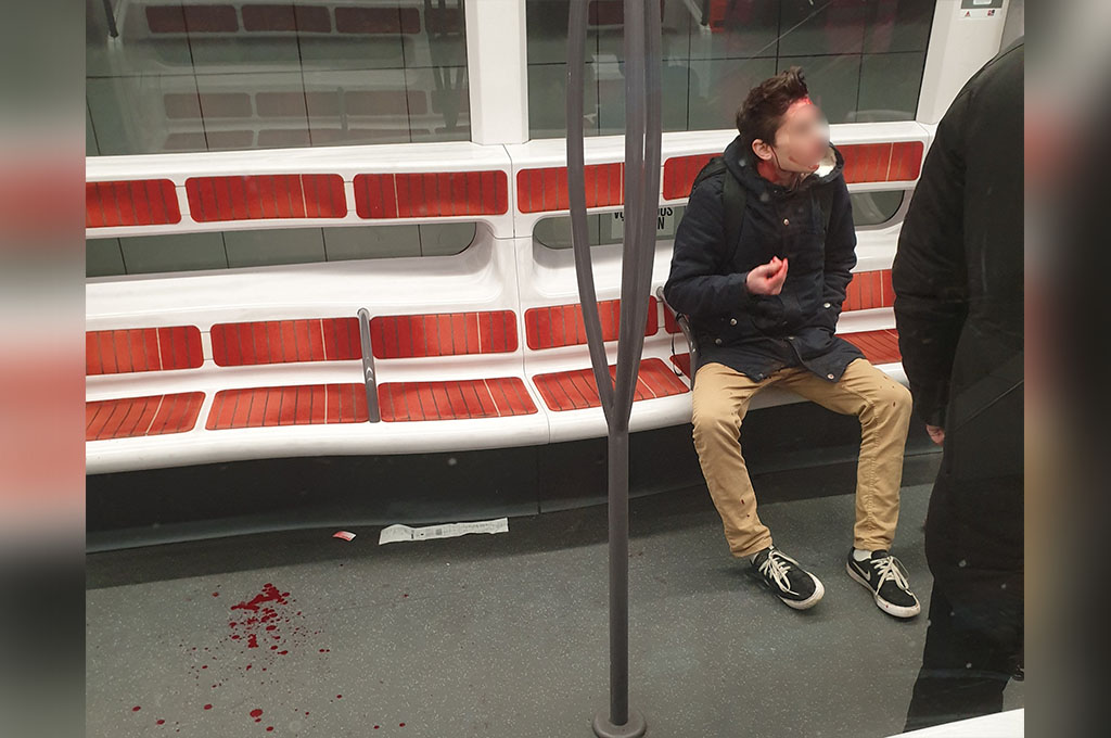 Lyon : Un jeune homme mis en joue et roué de coups dans le métro, les passagers interviennent