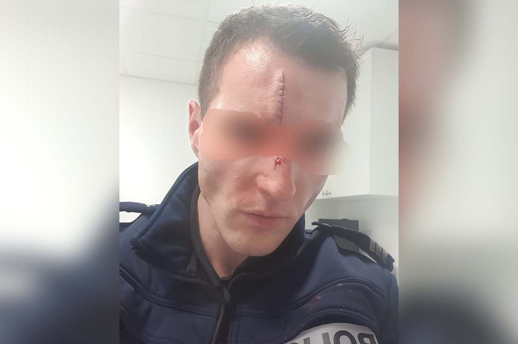 Berlaimont : Un policier reçoit un violent coup de tête au visage lors d'une intervention