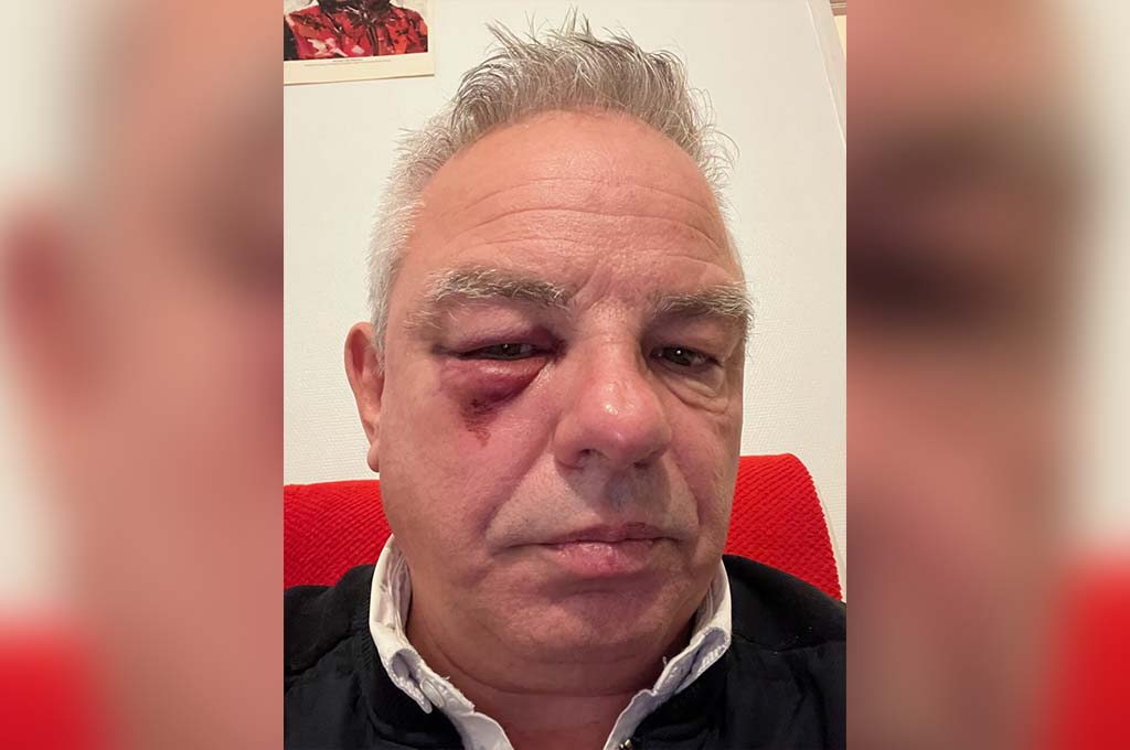 Un maire isérois violemment agressé dans le Vaucluse par plusieurs individus