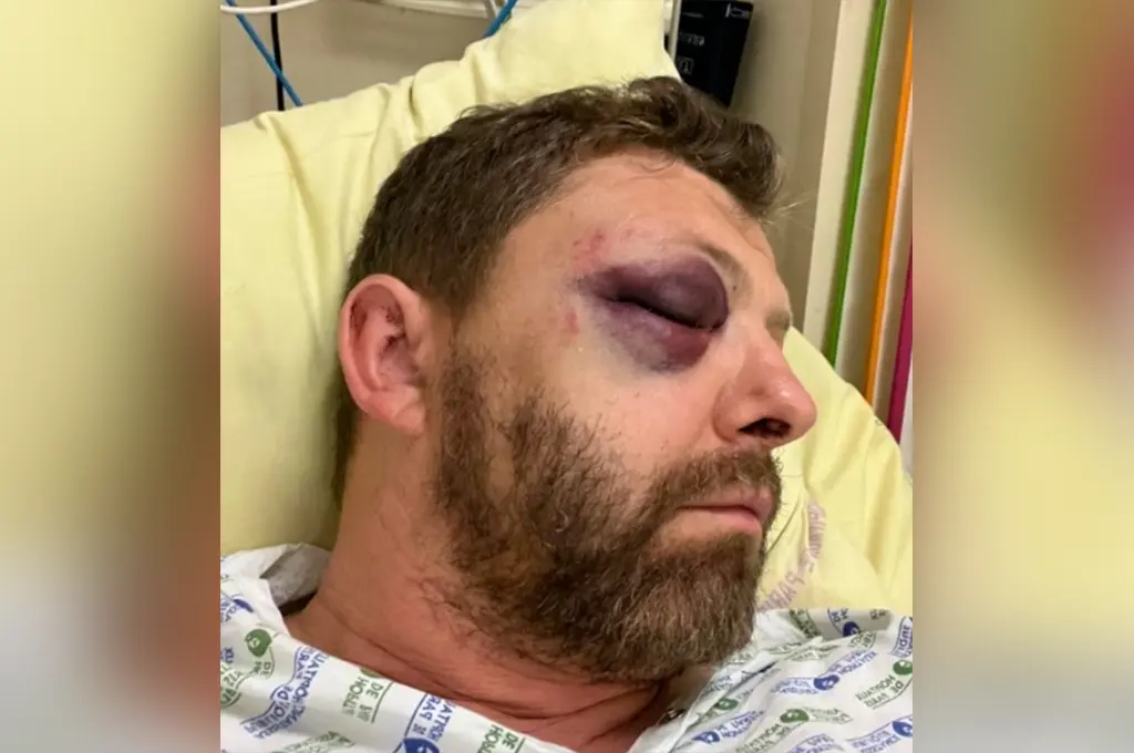 Paris : Le crâne ouvert à coups de bouteille, un policier, président de l'association FLAG !, victime d'une agression homophobe