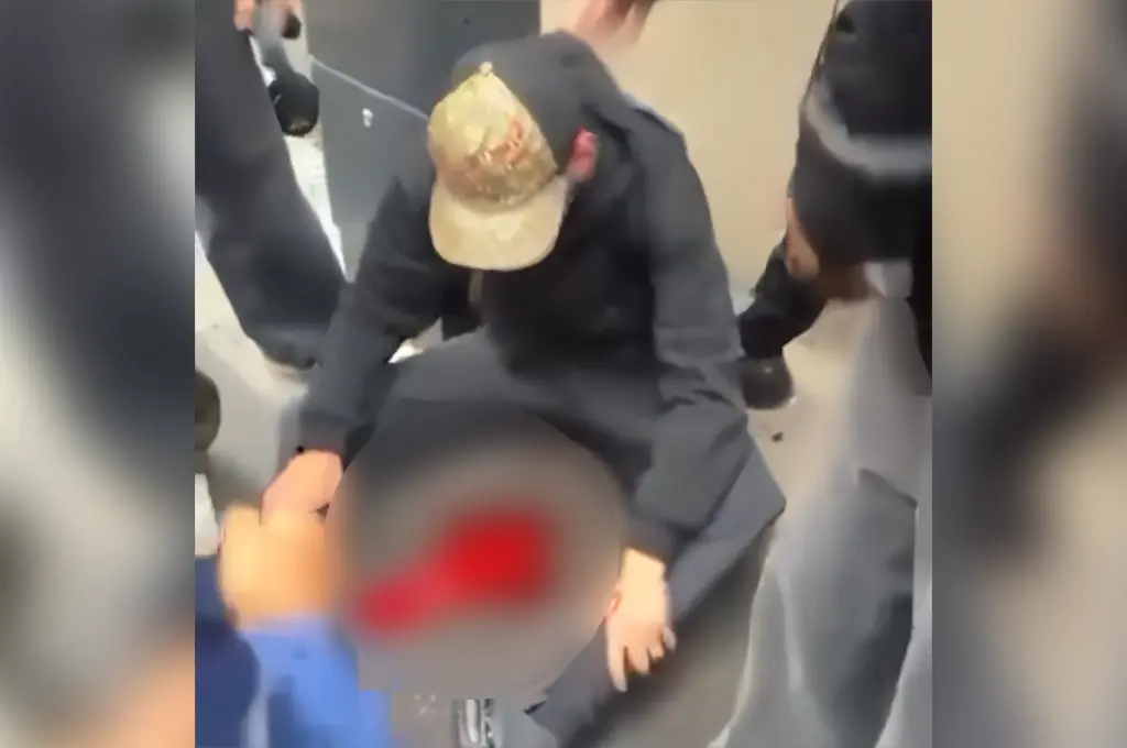Blocus des lycées : un jeune homme blessé au visage à Tours par un possible tir de LBD, l'IGPN saisie